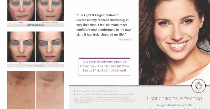 Laser Treatments